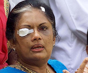Chandrika Kumaratunga had been injured in the attack. (File photo: EPS)