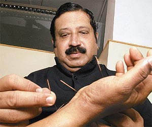 A demonstration on acupuncture performed by Dr M Muthukumar| p Jawahar