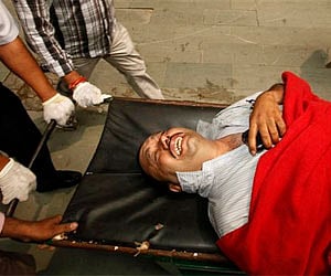 A person injured in a bomb explosion reacts in pain as he is brought to the RML hospital in New Delhi, India, Wednesday. AP