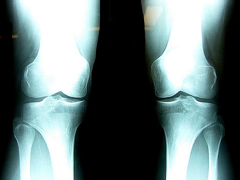 Image for representation purposes only. (Flickr/Creative Commons)