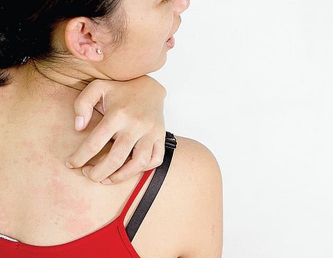 Killing the Scratch With Needles