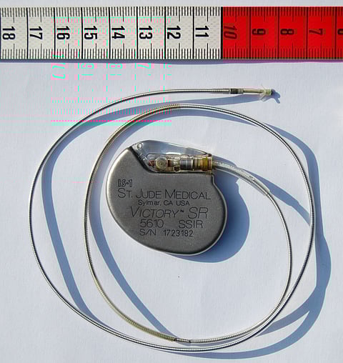 Patients Try Out Pacemaker Outside the Skin Before Committing to Invasive Procedure