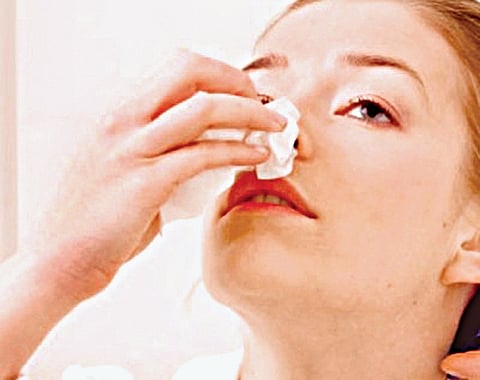 The Deal with Nose Bleeds