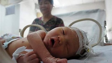 For representational purpose | AP