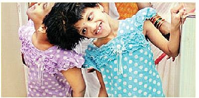 Surgery on conjoined twins Veena and Vani is risky, say AIIMS doctors