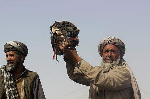 An Afghan man holds up the body of a child that was killed during clashes between Taliban and Afghan security forces.  (Photo | AP)
