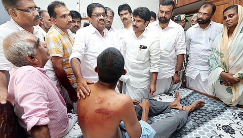 Congress leader V M Sudheeran visiting the people injured in police action, at a hospital at Mukkam in Kozhikode | Express