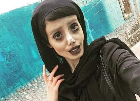 Sahar Tabar underwent 50 surgeries to look like Angelina Jolie. (Photo | Instagram)