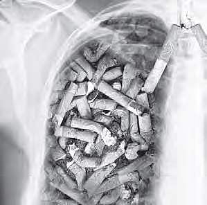 Want to quit smoking? Study says drop friends