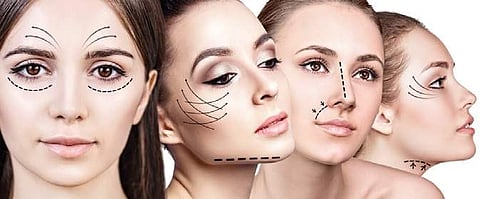 Lines are first drawn to demarcate the aging areas on the face