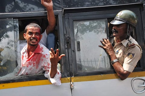 A bloodied PFI activist being taken away by police after Popular Front of India members clashed with police over arrest of fellow member | EPS