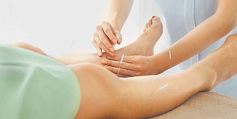 Acupuncture therapy relieves pain in polio paralysis patients