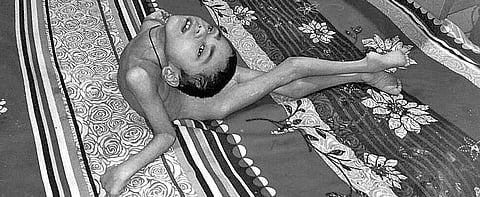 Parents of boy with cerebral palsy look for support