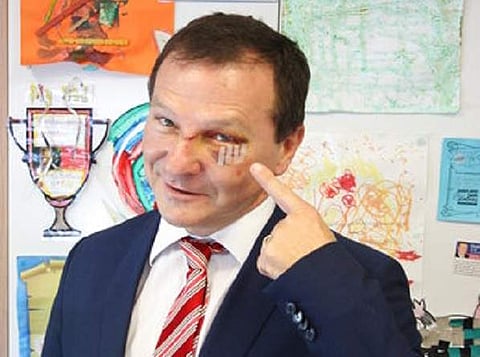 Australian lawmaker Graham Perrett poses in his office in the city of Brisbane, Australia to show his injuries sustained three days earlier while watching the satirical US TV series Veep. (Photo | AP)
