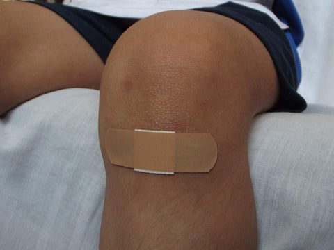 Flexible bio-glue for wound healing developed