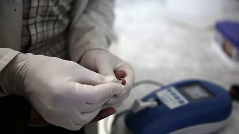 Image used for representational purposes only. 