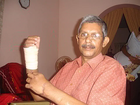 T J Joseph, professor of Thodupuzha Newman College, whose palm was chopped off by Muslim extremists (FIle | EPS)