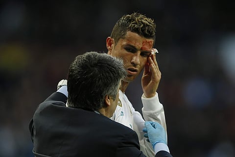 Real Madrid's Cristiano Ronaldo bleeds from his forehead during a Spanish La Liga soccer match between Real Madrid and Deportivo Coruna at the Santiago Bernabeu stadium in Madrid. | AP