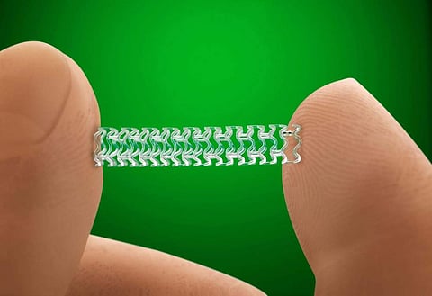On February 13 last year, the NPPA had brought stents under price control and capped ceiling price of coronary stents at Rs 7,260 for bare metal variety and Rs 29,600 for drug-eluting ones. (Photo | Associated Press)