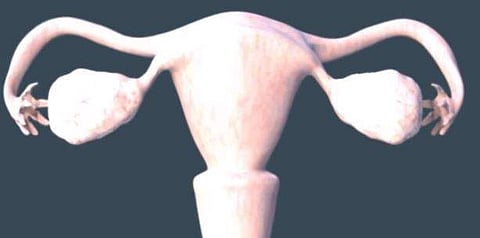 Representational image for PCOD. (Youtube Screengrab)