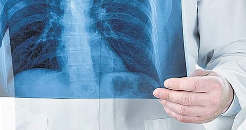 No licence for X-ray units at many government hospitals