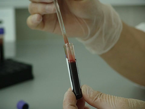 HIV+ woman files police complaint against Kilpauk Medical College Hospital