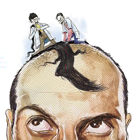 Dr Sydheendra Udbalker, dermatologist, says lifestyle and nutrition issues are making the gene that is responsible for male pattern baldness.