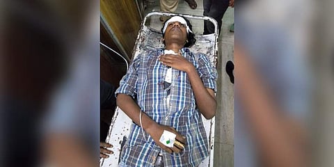 SFI activist Shinu who was attacked by CFI,SDPI activists (Photo | Facebook/SFI Iqbal college)