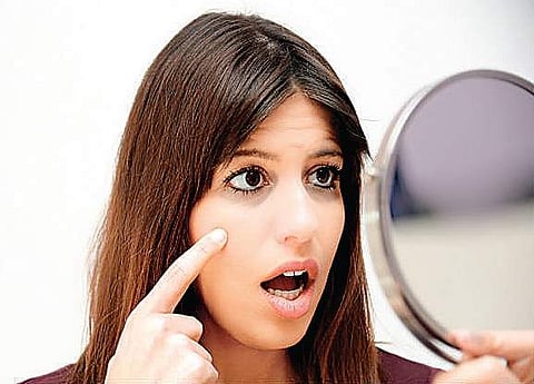 50 shades of dark circles