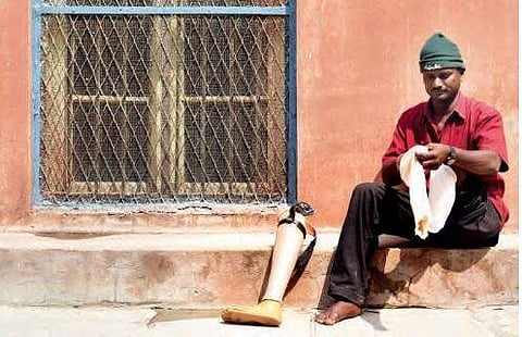 Hyderabad: Prisons department equips disabled man with artificial limb 