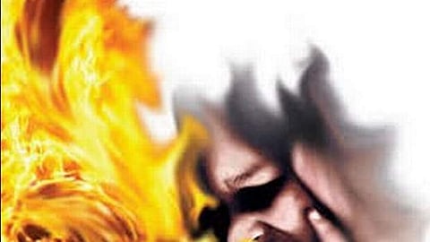 Image used for representational purpose.