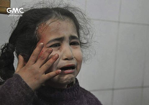 A Syrian young girl who was wounded during an airstrike. (Photo | AP)