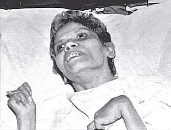 A file photo of Aruna Shanbaug