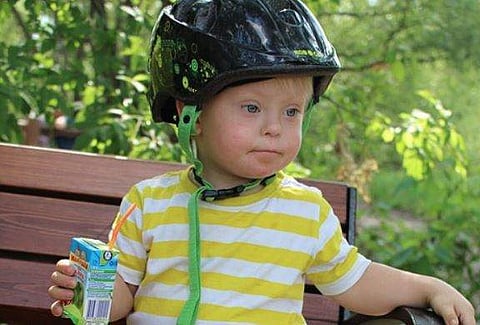 All you need to know about Down Syndrome