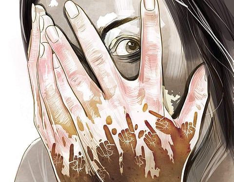 Spot the patch? Stop the stigma