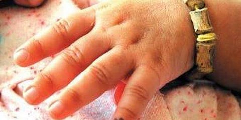 Image for representational purpose only