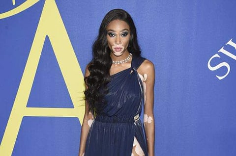 Model Winnie Harlow | AP