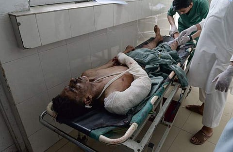 An Afghan victim receives treatments at an hospital following a suicide attack in Jalalabad. ()