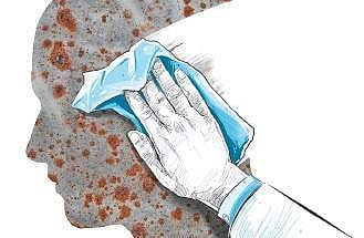 Knowing chickenpox - Cause,precaution and treatment