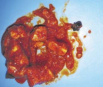 The insect that was found in MTR pickle