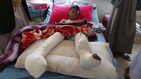 An injured child rests in a hospital a day after an airstrike in Saada, Yemen. (Photo | AP)