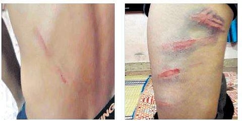 Bruises on the body of tenth class student Najibur Rahman | Express