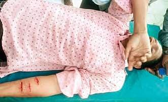 Sandeep, a ticket machine operator with HCU depot, at the hospital