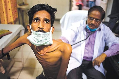 Tuberculosis is spread by the bacteria Mycobacterium tuberculosis which mainly affects the lungs but also other parts of the body. Image used for representational purpose. (File Photo)