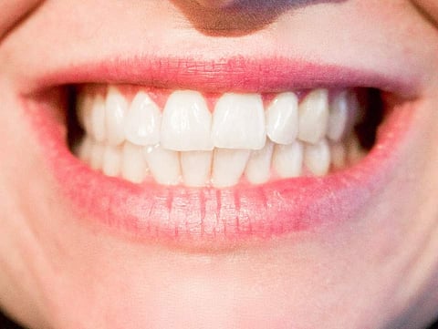 Teeth image used for representation