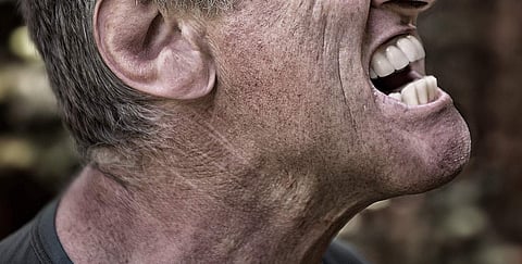 For representational purposes