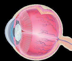 Representational image