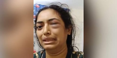 Jasmine Sultan appeared on the video crying with one of her eyes bleeding. (Twitter screengrab)