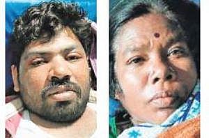 Woman, son injured in bee attack 