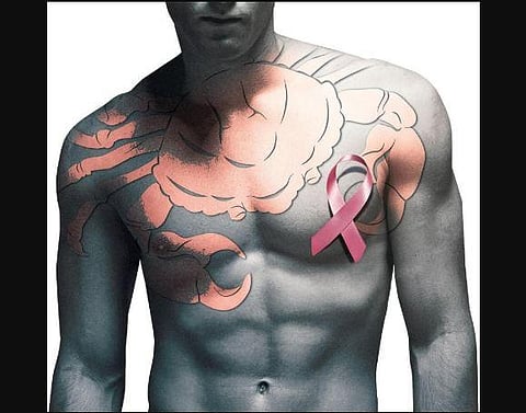 Image for representation.